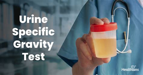 urine specific gravity mayo clinic